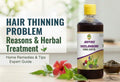 Hair Thinning Problem: Reasons and Herbal Treatment